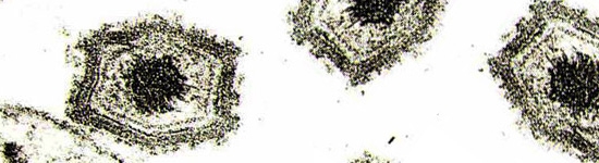 African Swine Fever Virus
