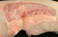 Subcutaneous oedema