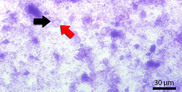 Fecal smear stained with Diff-Quick. Red arrow indicates the central vacuole. Black arrow indicates the nucleus