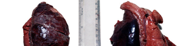 Acute unilateral Acpp from a 2 week old pig