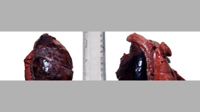 Acute unilateral Acpp from a 2 week old pig