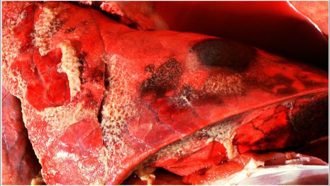 Acute pleuropneumonia in swine: three observations (indicated by arrows) can frequently be made: consolidated areas that are from dark red to black, interlobular edema and fibrinous pleuritis. Picture courtesy of Dr Robert Desrosiers

