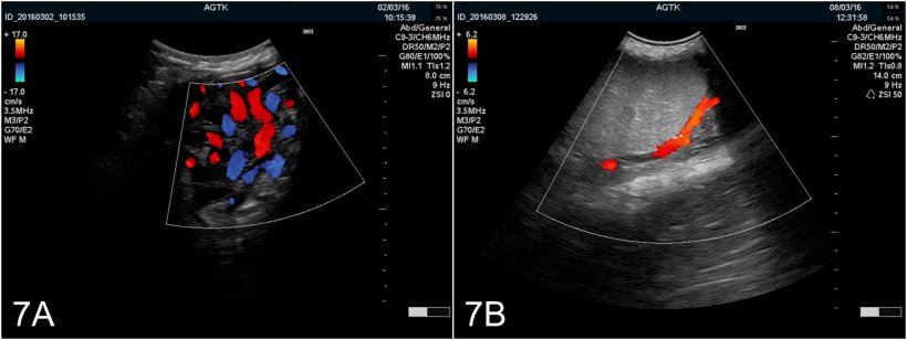 Fig. 7: Testis images obtained using Color-Doppler ultrasonography. A) Vessels of the spermatic cord. B) Arteria testicularis
