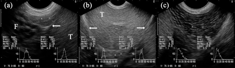 Fig. 5: Ultrasonographic images of the epididymal segments caput (= head; a), corpus (b) and cauda (= tail; c). Boxes marked with &ldquo;+&rdquo; and &ldquo;x&rdquo; are projected into the respective epididymal segments. Testis (T). Adjacent to the caput are multiple tubular structures identified as parts of the funiculus spermaticus (F). Arrows indicate the serosal testicular cover (i.e. bursa testicularis). (from Kauffold et al., 2011)
