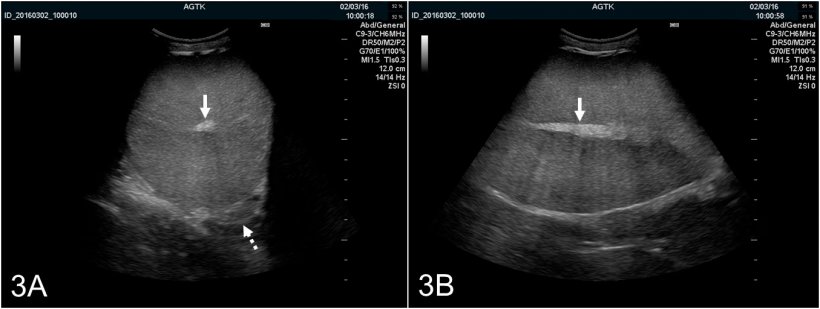 Fig. 3: Ultrasonographic images of the testis of a boar scanned transversally (A) and longitudinally (B). The rete testis is imaged as a hyperechogenic spot in the testis&rsquo;s center (solid arrow). The testicular parenchyma appears medium echogenic and of homogenous echotexture. Transversal imaging also provides optimal visualization of the epididymal corpus (dotted arrow), which is normally of similar ultrasonographic appearance as the testis.
