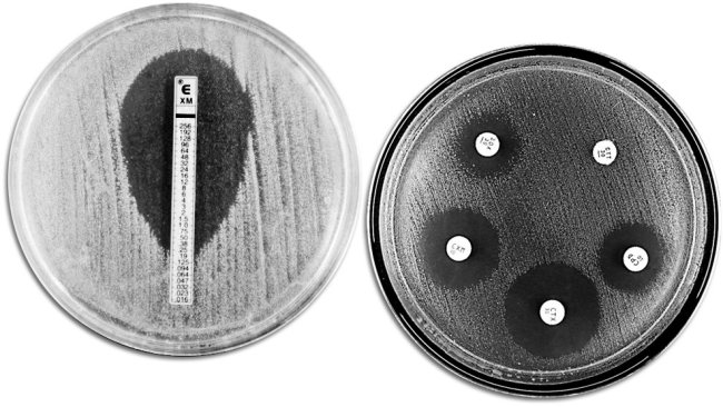 Classical techniques for evaluating antibiotic resistance. The picture shows an E-TEST on the left-hand side to measure the minimum concentration of antibiotic that prevents bacterial growth. The right-hand side shows an antimicrobial susceptibility test with different growth inhibition zones produced by the antibiotics.