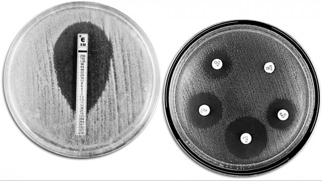 Classical techniques for evaluating antibiotic resistance. The picture shows an E-TEST on the left-hand side to measure the minimum concentration of antibiotic that prevents bacterial growth. The right-hand side&nbsp;shows an antimicrobial susceptibility test with different growth inhibition zones produced by the antibiotics.
