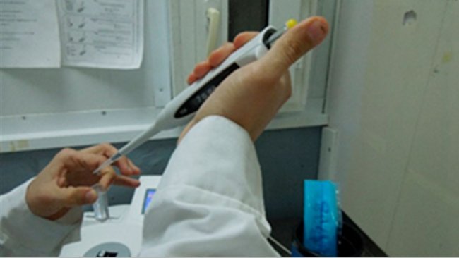 Semen evaluation