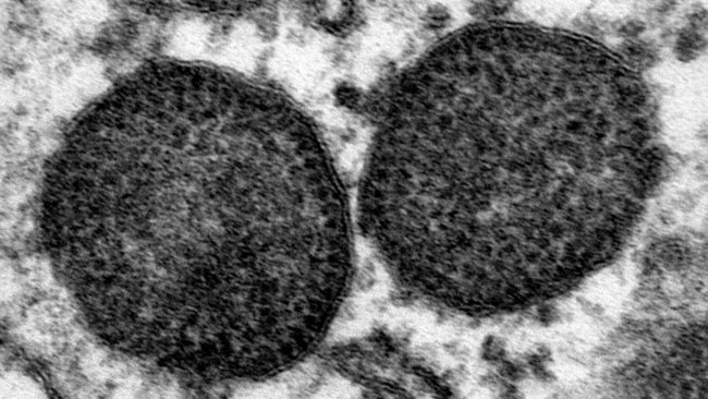 Electron micrograph of two inclusion bodies in the cytoplasm of a macrophage, including a very high number of PCV2 particles. 150.000x. Source: Carolina Rodríguez-Cariño, CReSA