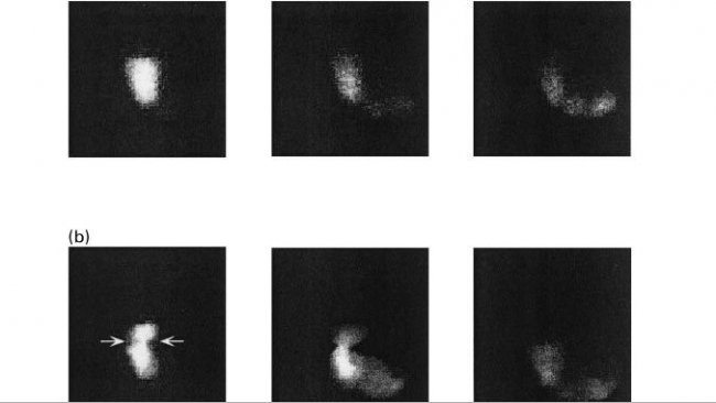 Figure 1. Images of gastric emptying in pigs fed a diet based on starch (a), beet pulp (b) and wheat bran at 10, 60 and 120 minutes post-ingestion (Source: Guerin et al., 2001 ).