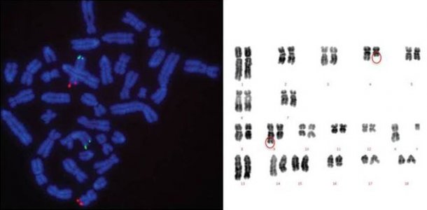 Các vấn đề về Karyotype có thể làm giảm đột ngột khả năng sinh sản và / hoặc khả năng sinh sản khi lợn đực giống đó được sử dụng trong hệ thống sản xuất.