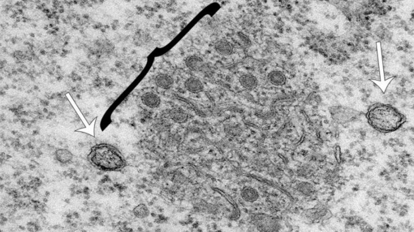 Electron micrograph of the two replication organelle structures. White arrows indicate double membrane vesicles and the black bracket encompasses the small circular spherules which protrude from the zippered endoplasmic reticulum (ER) that appear as tubular shapes.
