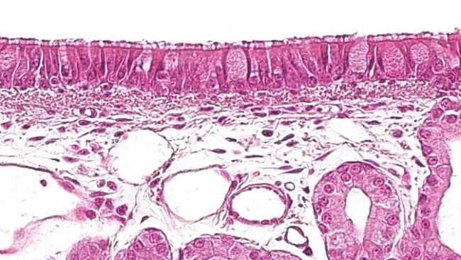 Figure 1: Ciliated pseudostratified epithelium with goblet cells, characteristic of the respiratory system.