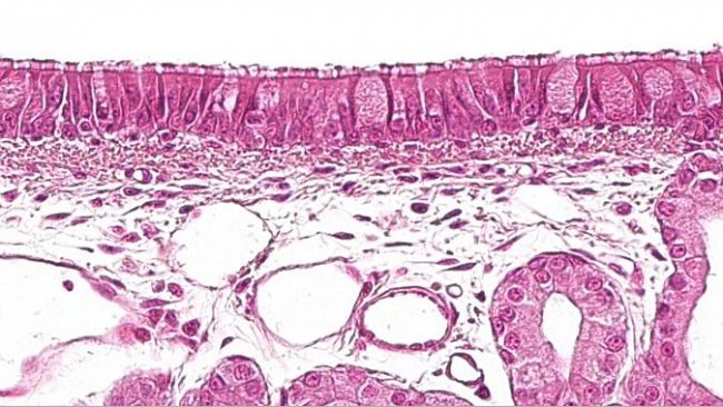 Figure&nbsp;1: Ciliated pseudostratified epithelium with goblet cells,&nbsp;characteristic of the respiratory system.
