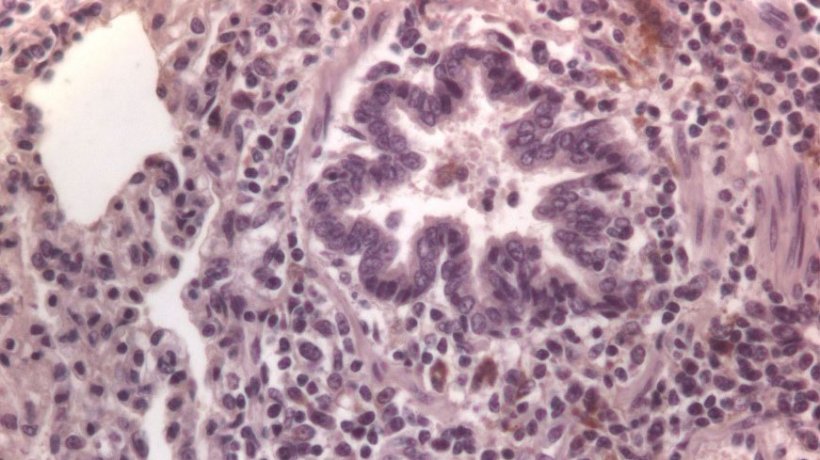 Figure&nbsp;3: Cells immunolabelled for PCV2 in the lung.
