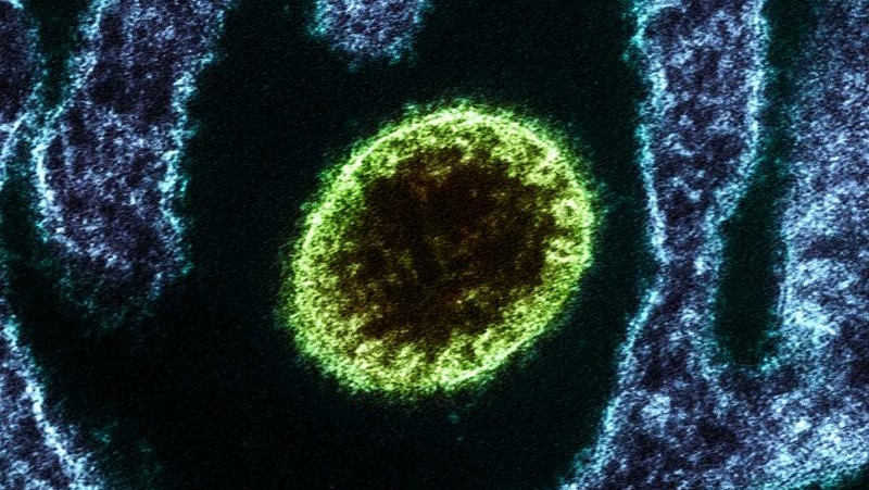 Colourised transmission electron micrograph of a&nbsp;Nipah Virus particle (green) near the edge of an infected&nbsp;cell (blue). Image captured and colour-enhanced at the NIAID Integrated Research Facility in Fort Detrick, Maryland. Credit:&nbsp;NIAID
