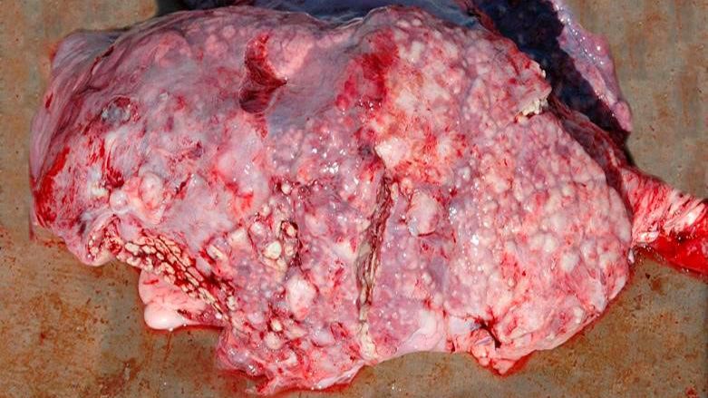 Figure&nbsp;5: Embolic pneumonia caused by T. pyogenes.
