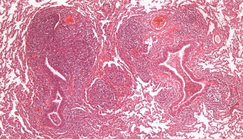 Figure&nbsp;2: Peribronchiolar lymphoid tissue hyperplasia caused by M. hyopneumoniae.
