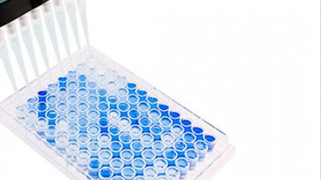 Photo 1. Flat-bottomed, 96-well ELISA plate used for PRRSV serology. Positive samples are shown in blue. Source: Base Pair Biotechnologies.
