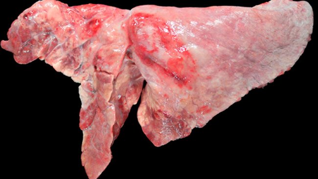 Figure 5: Pig lung co-infected with M. hyopneumoniae and A. pleuropneumoniae.  Cranioventral areas of consolidation with a reddish-brown color, caused by infection by M. hyopneumoniae, and an oval-shaped lesion with pleural fibrosis and hemorrhagic area in the diaphragmatic lobe, which would correspond to the chronical stage after an outbreak of necrosis caused by A. pleuropneumoniae.