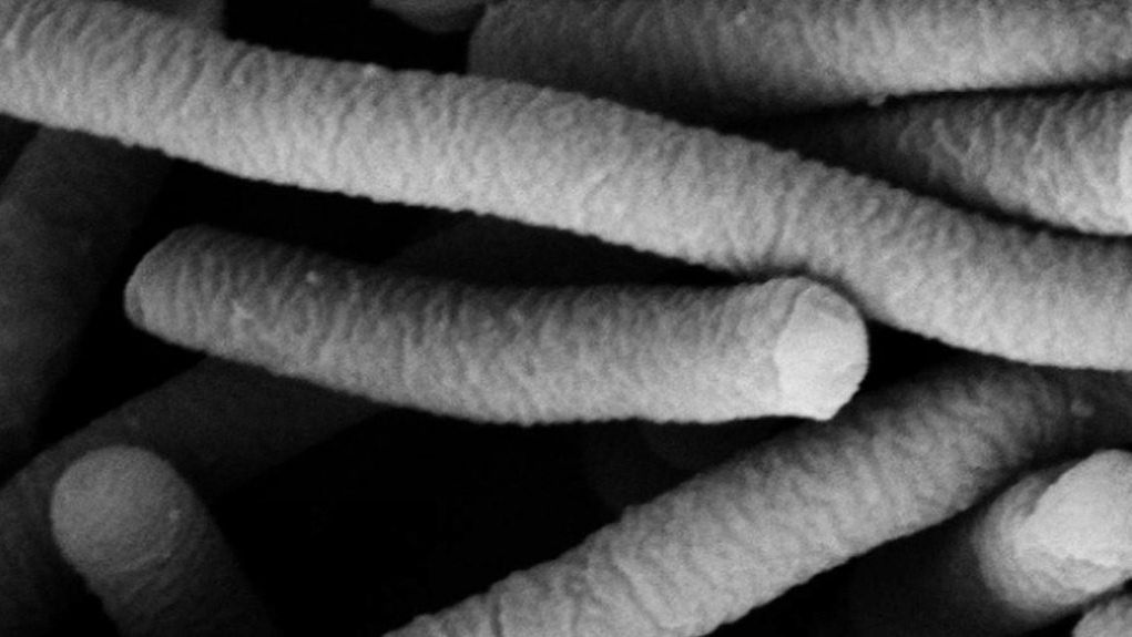Photo 1. Electron micrograph of Lactobacillus acidophilus, which has probiotic characteristics. Photo by&nbsp;Mogana Das Murtey and Patchamuthu Ramasamy.
