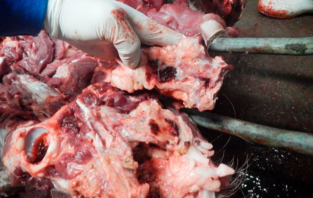<p>Hematomas and necrosis around a fracture</p>
