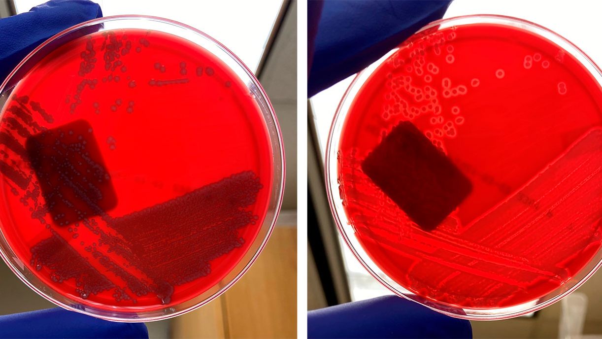 Non hemolytic E coli (left) and hemolytic E coli (right).
