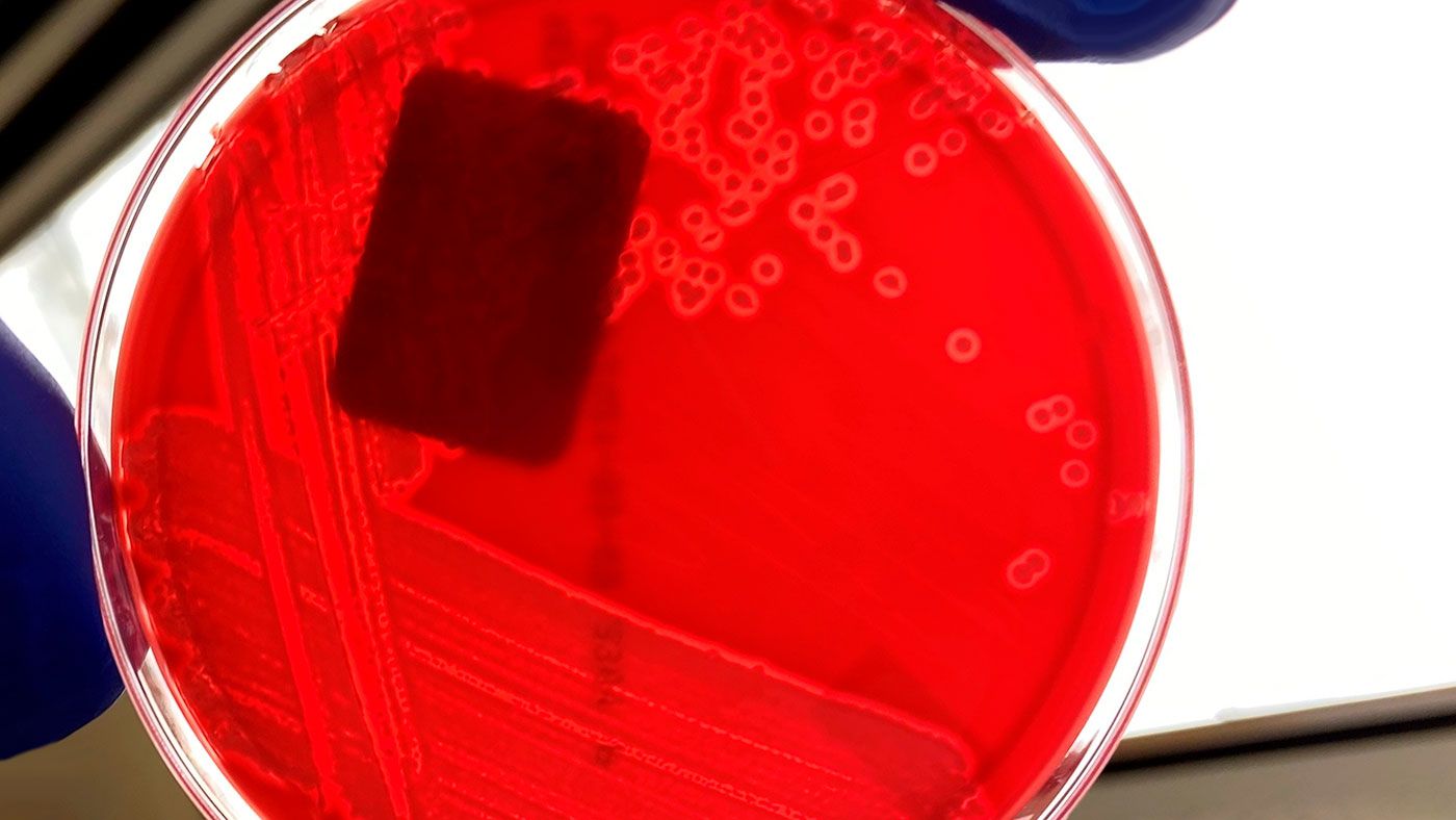 Figure 1. Pure culture of haemolytic E. coli on a blood agar plate.&nbsp; Note the clear zone around each bacterial colony indicating hemolysis (breaking down of blood in plate agar). Photo Credits: Iowa State University, Veterinary Diagnostic Laboratory, Bacteriology Section

