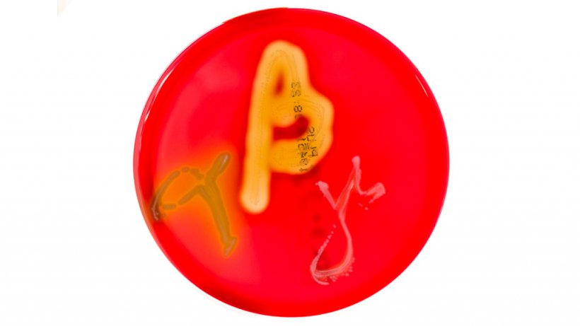 Figure 1. Petri dishes cultures on blood agar demonstrating alpha, beta, and gamma hemolysis. Source: Mibilehr https://creativecommons.org/licenses/by-sa/4.0/deed.ene 