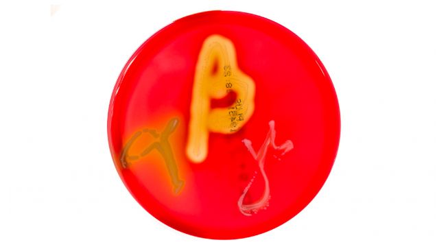 Figure 1. Petri dishes cultures on blood agar demonstrating alpha, beta, and gamma hemolysis. Source:&nbsp;Mibilehr https://creativecommons.org/licenses/by-sa/4.0/deed.ene&nbsp;
