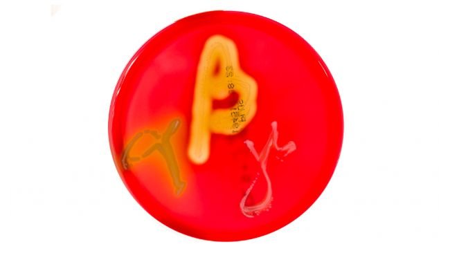 Figure 1. Petri dishes cultures on blood agar demonstrating alpha, beta, and gamma hemolysis. Source: Mibilehr https://creativecommons.org/licenses/by-sa/4.0/deed.ene 