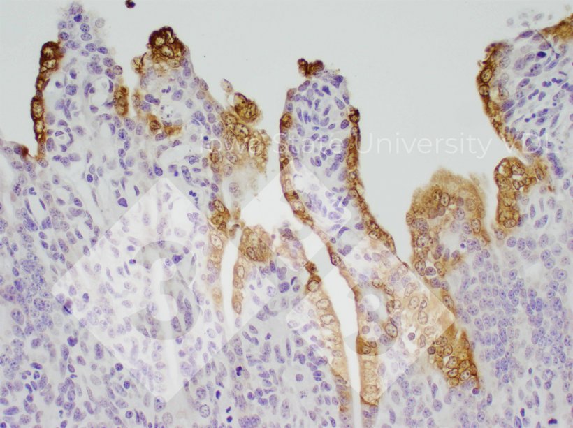 Figure 1. PED IHC staining of infected small intestine. Source: Iowa State University VDL.