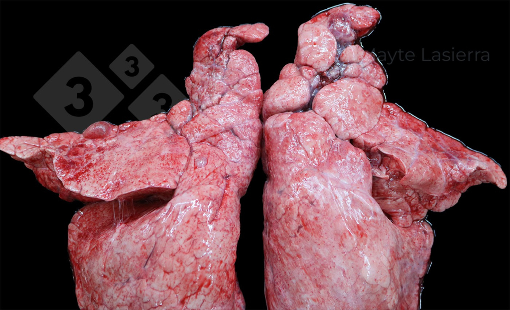 <p>Cranial pleuritis</p>
