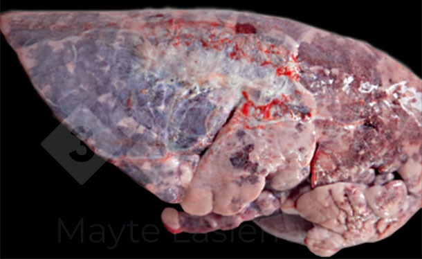 <p>Dorsocaudal pleuritis</p>

