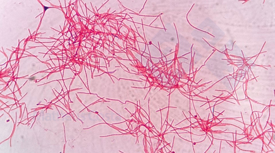 Fusobacterium necrophorum under the microscope.