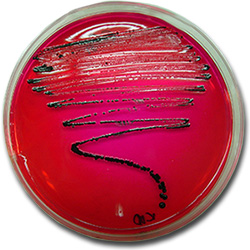 Isolation of Salmonella in XLD. In this culture medium the Salmonella colonies grow with a black colour due to the production of hydrogen sulphide