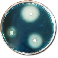 Isolation of Salmonella in MSRV