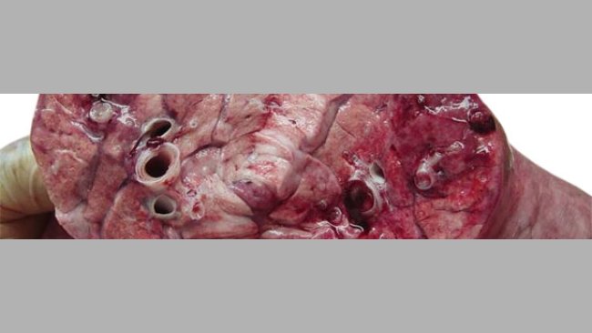Lung cross-section