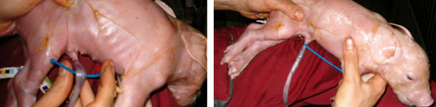 Tying the navel cords with tie wraps