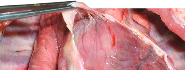 Delicate and fragile fibrin between the epicardium and pericardial sac