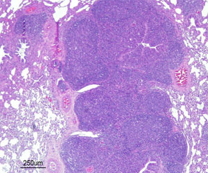 Broncho-interstitial pneumonia with broncho-alveolar lymphoid tissue (BALT) hyperplasia caused by a Mhyo experimental infection