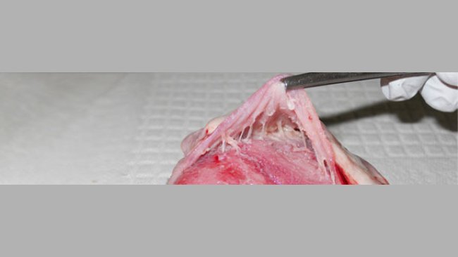 Heart, pericarditis observed with M. hyorhinis systemic disease