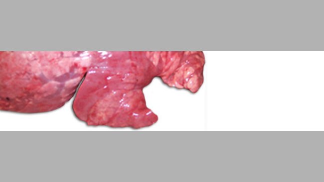 Pneumonia
