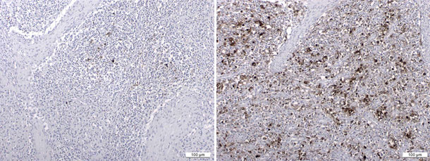 PCV2 antigen detected by an immunohistochemistry technique