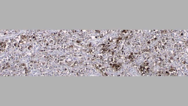 PCV2 antigen detected by an immunohistochemistry technique