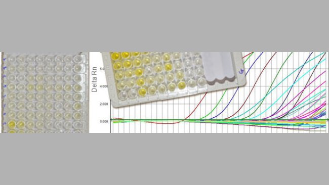 Serologies against PCV2 normally distinguish between IgM and IgG, and q-PCR gives us information about the viral load