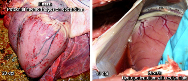 Hydrothorax 