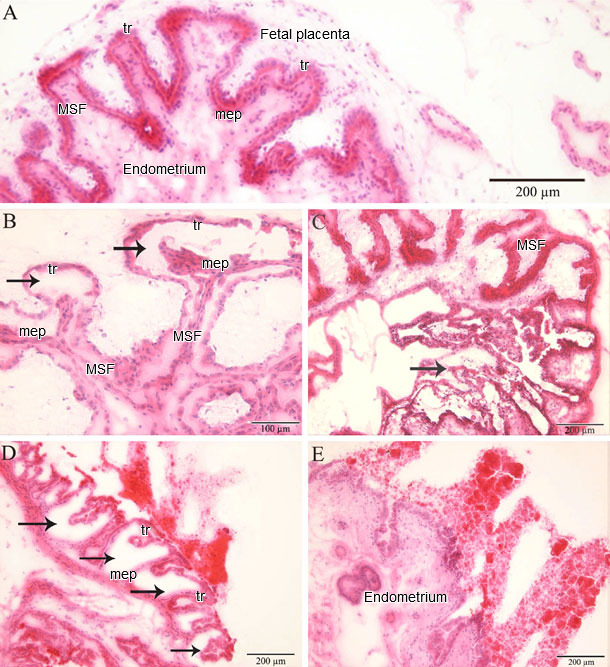 Histopathology in the endometrium and placenta