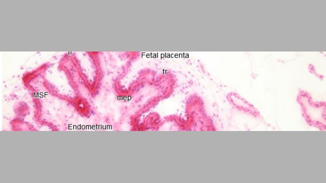 Histopathology in the endometrium and placenta