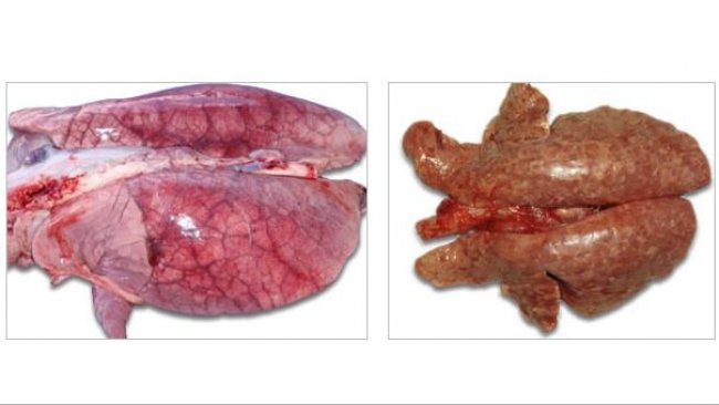 Lungs